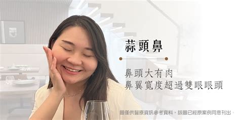 鼻頭大原因|鼻頭很大還有救！破解坊間迷思，了解縮鼻頭方法與5。